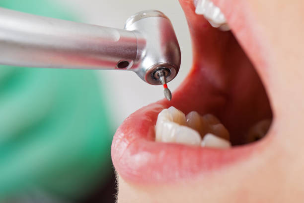 Best Emergency Treatment for Dental Infections or Abscesses in Seaman, OH